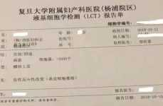 什么是tct和hpv,宫颈癌筛查的“双剑合璧”